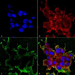 Invitrogen LRP4 Monoclonal Antibody (N207/27) 100 &mu;g; Unconjugated:Antibodies,