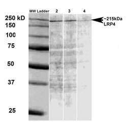 Invitrogen LRP4 Monoclonal Antibody (N207/27) 100 &mu;g; Unconjugated:Antibodies,