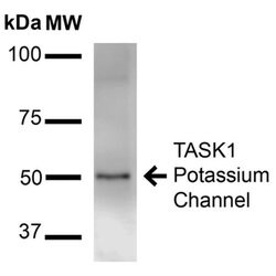 Invitrogen KCNK3 Monoclonal Antibody (N374/48) 100 &mu;g; Unconjugated:Antibodies,