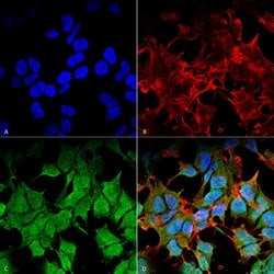 Invitrogen Kir6.1 (KCNJ8) Monoclonal Antibody (N366/60) 100 &mu;g; Unconjugated:Antibodies,