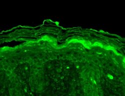 KV3.4 (KCNC4) Monoclonal Antibody (S72-16), Invitrogen 100 &mu;g; Unconjugated:Antibodies,