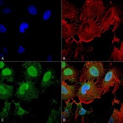 Invitrogen mGluR5 Monoclonal Antibody (N75/3) 100 &mu;g; Unconjugated:Antibodies,