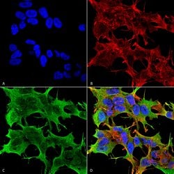 Invitrogen&trade;&nbsp;GluR1 Monoclonal Antibody (N355/1)