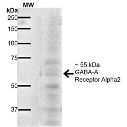 Invitrogen GABRA2 Monoclonal Antibody (N399/19) 100 &mu;g; Unconjugated:Antibodies,