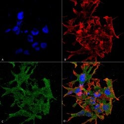 Invitrogen GABBR1 Monoclonal Antibody (N93A/49) 100 &mu;g; Unconjugated:Antibodies,