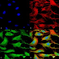 Invitrogen ATP7B Monoclonal Antibody (L62/29) 100 &mu;g; Unconjugated:Antibodies,
