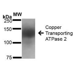 Invitrogen ATP7B Monoclonal Antibody (L62/29) 100 &mu;g; Unconjugated:Antibodies,