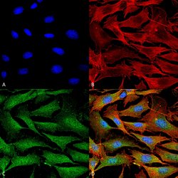Invitrogen ATP7A Monoclonal Antibody (L60/4) 100 &mu;g; Unconjugated:Antibodies,