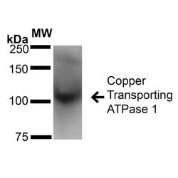 Invitrogen ATP7A Monoclonal Antibody (L60/4) 100 &mu;g; Unconjugated:Antibodies,