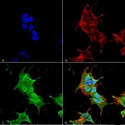 Invitrogen Ankyrin 1 Monoclonal Antibody (N388A/10) 100 &mu;g; Unconjugated:Antibodies,