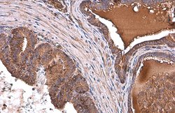 Invitrogen ALDH1A3 Monoclonal Antibody (GT926) 100 &mu;L; Unconjugated:Antibodies,
