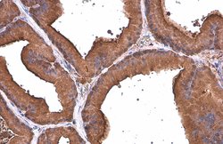 Invitrogen ALDH1A3 Monoclonal Antibody (GT926) 100 &mu;L; Unconjugated:Antibodies,