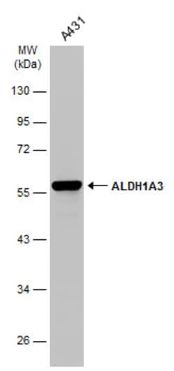 Invitrogen ALDH1A3 Monoclonal Antibody (GT926) 100 &mu;L; Unconjugated:Antibodies,