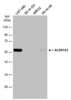 Invitrogen ALDH1A3 Monoclonal Antibody (GT926) 100 &mu;L; Unconjugated:Antibodies,