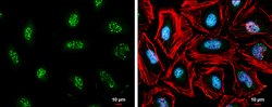 Invitrogen cIAP1 Monoclonal Antibody (GT422) 100 &mu;L; Unconjugated:Antibodies,