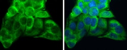 Invitrogen ATP6V1A Monoclonal Antibody (GT811) 100 &mu;L; Unconjugated:Antibodies,