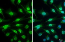 Invitrogen Phospho-ATR (Thr1989) Monoclonal Antibody (GT222) 100 &mu;L;