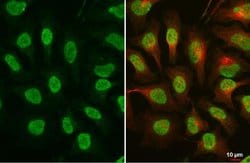 Invitrogen Phospho-ATR (Thr1989) Monoclonal Antibody (GT222) 100 &mu;L;