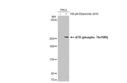 Invitrogen Phospho-ATR (Thr1989) Monoclonal Antibody (GT222) 100 &mu;L;