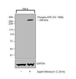 Invitrogen Phospho-ATR (Thr1989) Monoclonal Antibody (GT222) 100 &mu;L;