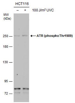 Invitrogen Phospho-ATR (Thr1989) Monoclonal Antibody (GT222) 100 &mu;L;