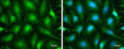 Invitrogen Phospho-ATR (Thr1989) Monoclonal Antibody (GT222) 100 &mu;L;