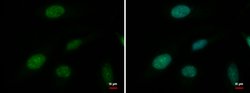 Invitrogen ATRX Monoclonal Antibody (GT4212) 100 &mu;L; Unconjugated:Antibodies,
