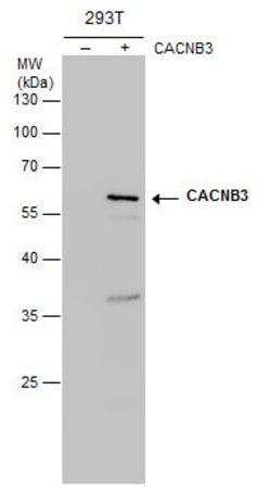 CACNB3 Monoclonal Antibody (7D1), Invitrogen 100 &mu;L; Unconjugated:Antibodies,