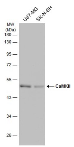 Invitrogen CaMKII delta Monoclonal Antibody (GT4811) 100 &mu;L | Buy Online | Invitrogen&trade; | Fisher Scientific