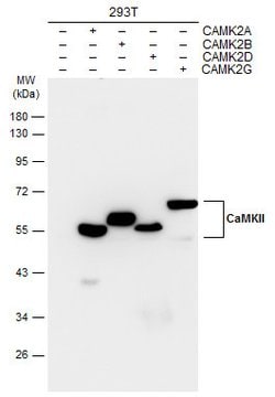 Invitrogen CaMKII delta Monoclonal Antibody (GT4811) 100 &mu;L | Buy Online | Invitrogen&trade; | Fisher Scientific