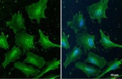 Invitrogen Cofilin Monoclonal Antibody (GT217) 100 &mu;L; Unconjugated:Antibodies,