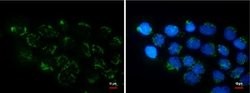 COL11A2 Monoclonal Antibody (GT473), Invitrogen 100 &mu;L; Unconjugated:Antibodies,