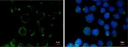 COL11A2 Monoclonal Antibody (GT473), Invitrogen 100 &mu;L; Unconjugated:Antibodies,
