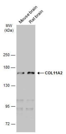 COL11A2 Monoclonal Antibody (GT473), Invitrogen 100 &mu;L; Unconjugated:Antibodies,
