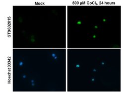 Invitrogen HIF-2 alpha Monoclonal Antibody (GT125) 100 &mu;L | Buy Online | Invitrogen&trade; | Fisher Scientific
