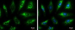 Invitrogen Fumarase Monoclonal Antibody (GT7612) 100 &mu;L; Unconjugated:Antibodies,