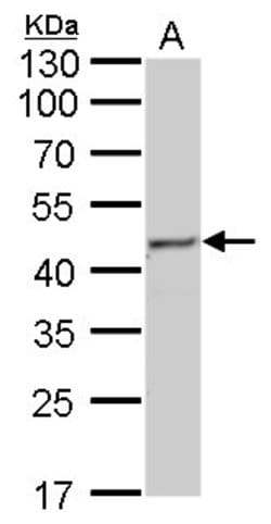 Invitrogen Fumarase Monoclonal Antibody (GT7612) 100 &mu;L; Unconjugated:Antibodies,