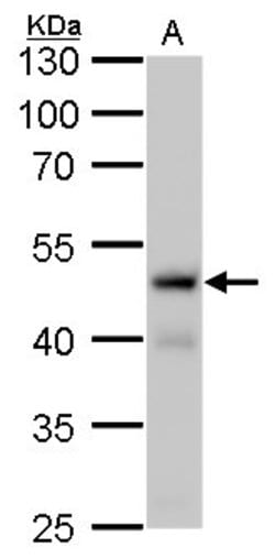 Invitrogen Fumarase Monoclonal Antibody (GT7612) 100 &mu;L; Unconjugated:Antibodies,