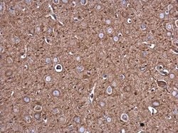 Invitrogen Filamin B Monoclonal Antibody (GT1372) 100 &mu;L; Unconjugated:Antibodies,
