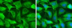 Invitrogen GOT1 Monoclonal Antibody (GT1255) 100 &mu;L; Unconjugated:Antibodies,