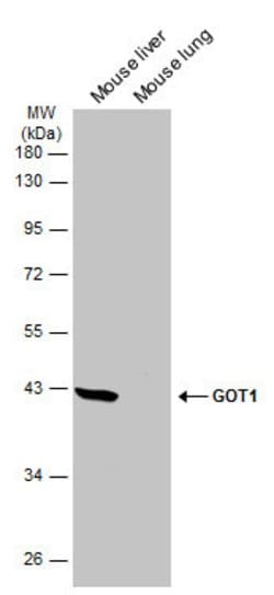 Invitrogen GOT1 Monoclonal Antibody (GT1255) 100 &mu;L; Unconjugated:Antibodies,