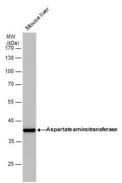 Invitrogen GOT1 Monoclonal Antibody (GT1255) 100 &mu;L; Unconjugated:Antibodies,