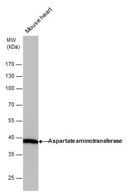 Invitrogen GOT1 Monoclonal Antibody (GT1255) 100 &mu;L; Unconjugated:Antibodies,