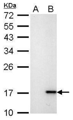 Invitrogen Phospho-Histone H2A.X (Ser139) Monoclonal Antibody (GT2311)
