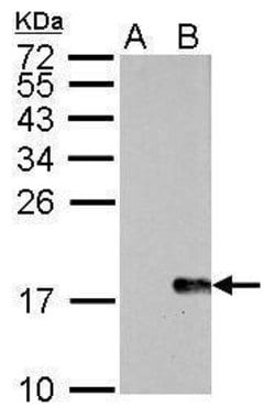 Invitrogen Phospho-Histone H2A.X (Ser139) Monoclonal Antibody (GT2311)