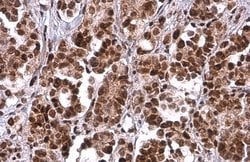 Invitrogen PRMT1 Monoclonal Antibody (GT779) 100 &mu;L | Buy Online | Invitrogen&trade; | Fisher Scientific