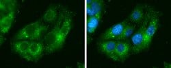 Invitrogen IDH1 Monoclonal Antibody (GT1521) 100 &mu;L; Unconjugated:Antibodies,