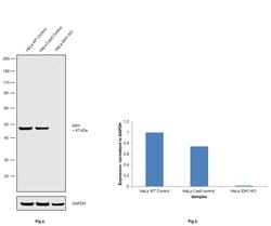 Invitrogen IDH1 Monoclonal Antibody (GT1521) 100 &mu;L; Unconjugated:Antibodies,