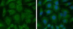 Invitrogen ME1 Monoclonal Antibody (GT979) 100 &mu;L; Unconjugated:Antibodies,