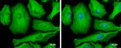 Invitrogen Phospho-MYH9 (Ser1943) Monoclonal Antibody (GT144) 100 &mu;L;